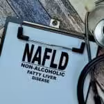Non-Alcoholic Fatty Liver Disease on Paper attached to Clip Board